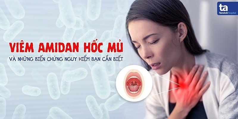 viêm amidan hốc mủ