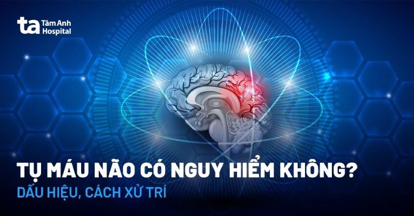 tụ máu não có nguy hiểm không