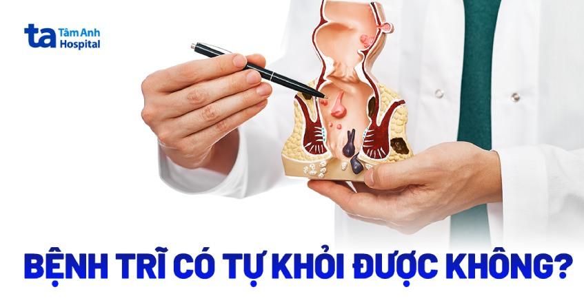 bệnh trĩ có tự khỏi được không