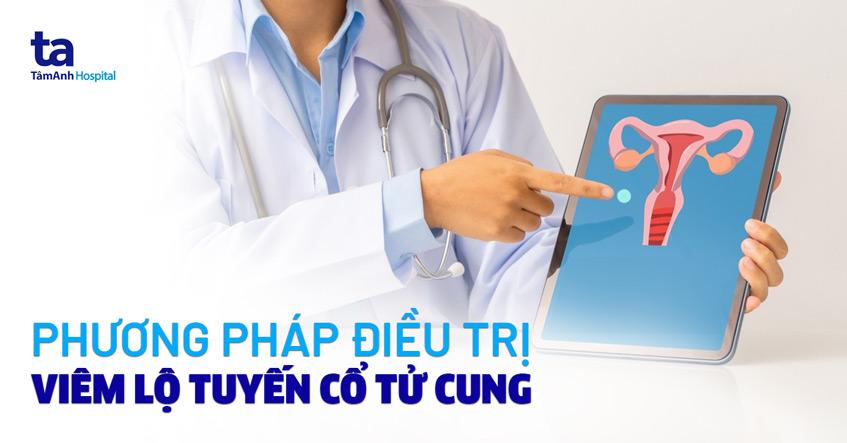 điều trị viêm lộ tuyến cổ tử cung