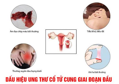 10 dấu hiệu nhận biết ung thư cổ tử cung không thể bỏ qua