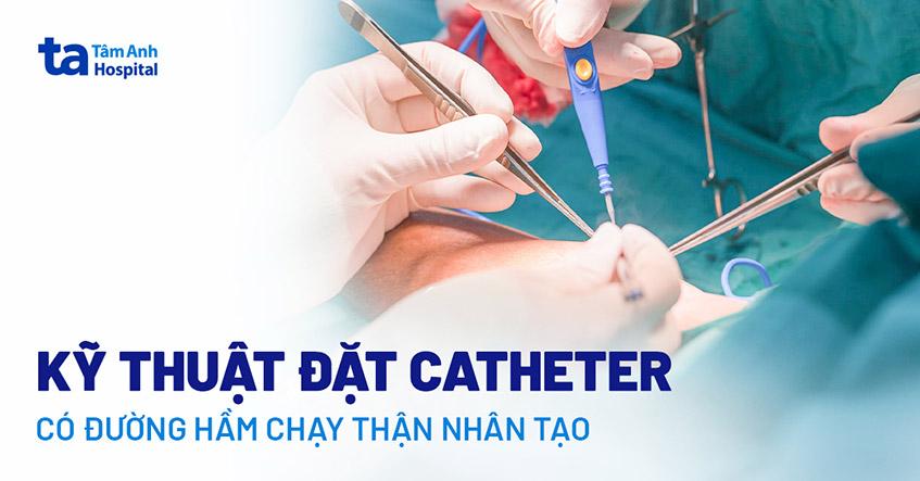 Kỹ thuật đặt catheter có đường hầm chạy thận nhân tạo