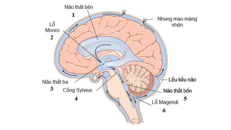 Nang màng nhện có nguy hiểm không? Tìm hiểu về triệu chứng, nguy cơ và điều trị hiệu quả 1