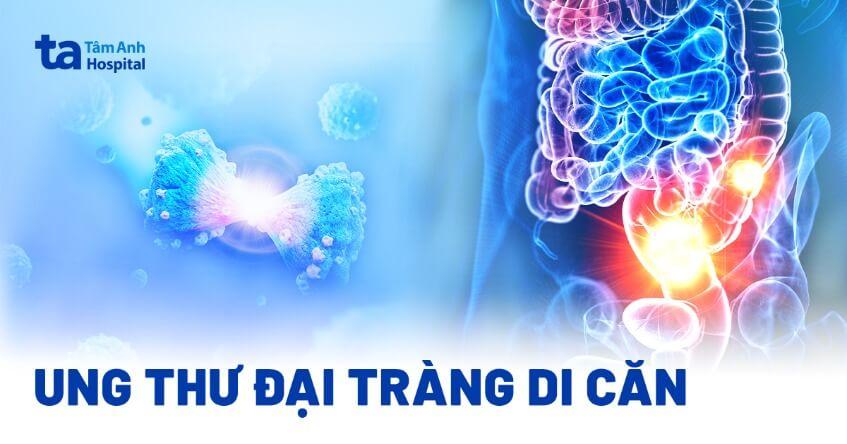 ung thư đại tràng di căn