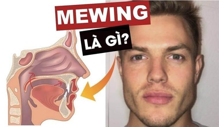 Mewing là gì? Những thông tin liên quan đến Mewing