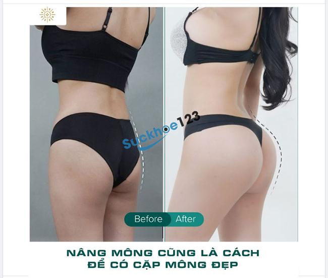 Mông Đẹp và Các Tiêu Chí Đánh Giá Cặp Mông Đẹp