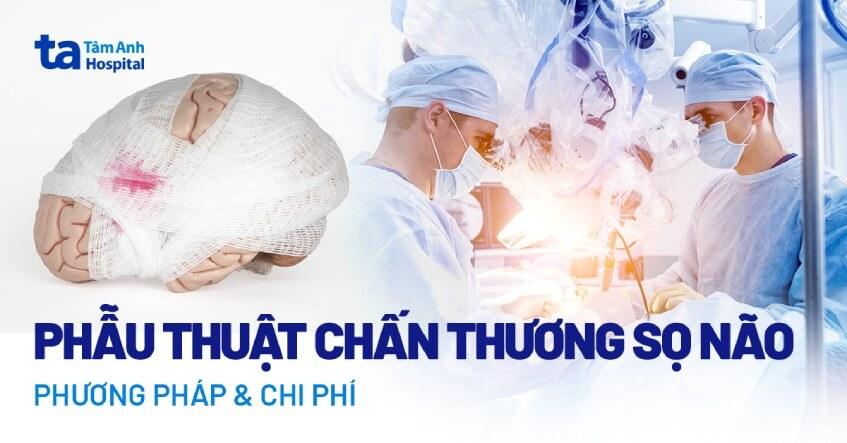 Phẫu thuật chấn thương sọ não: Các phương pháp mổ và chi phí