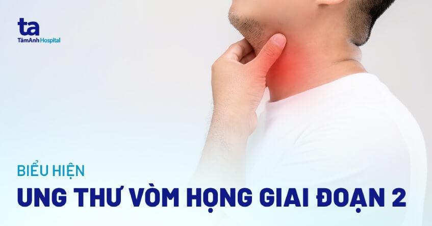 Ung thư vòm họng giai đoạn 2: Triệu chứng, chẩn đoán và điều trị