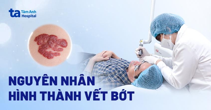 vết bớt