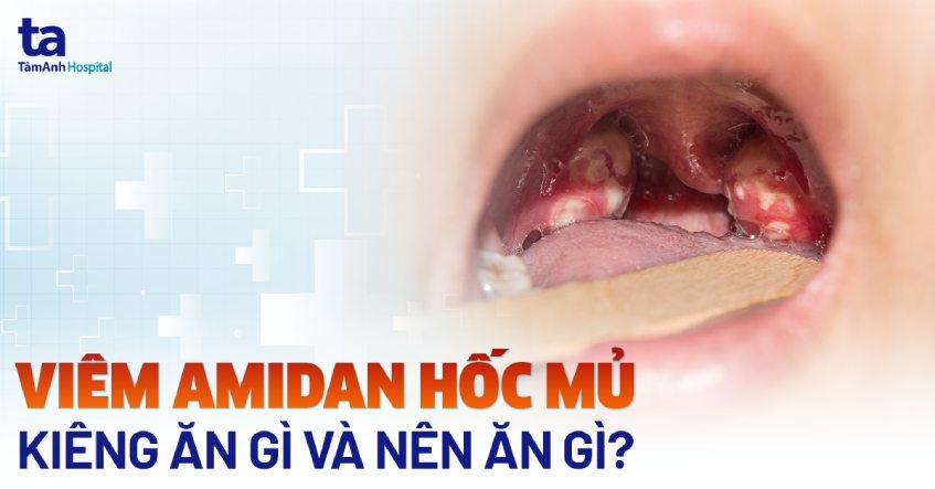 Viêm amidan hốc mủ kiêng ăn gì và nên ăn gì tốt cho người bệnh?