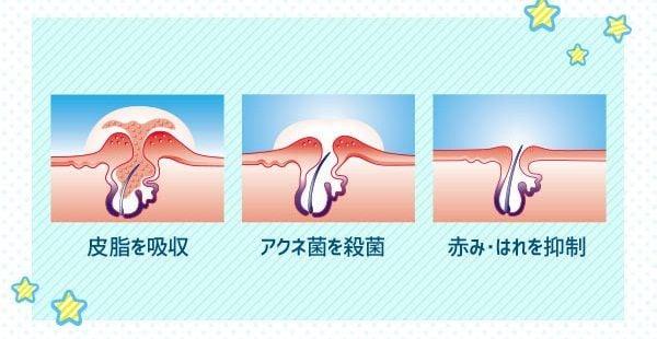 Gel trị mụn Sato Dalacin T 1% 10g - Chuỗi siêu thị Nhật Bản nội địa - Made in Japan Konni39 tại Việt Nam