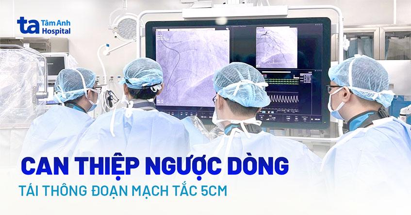 Tái thông mạch máu cho người đàn ông nghiện thuốc lá