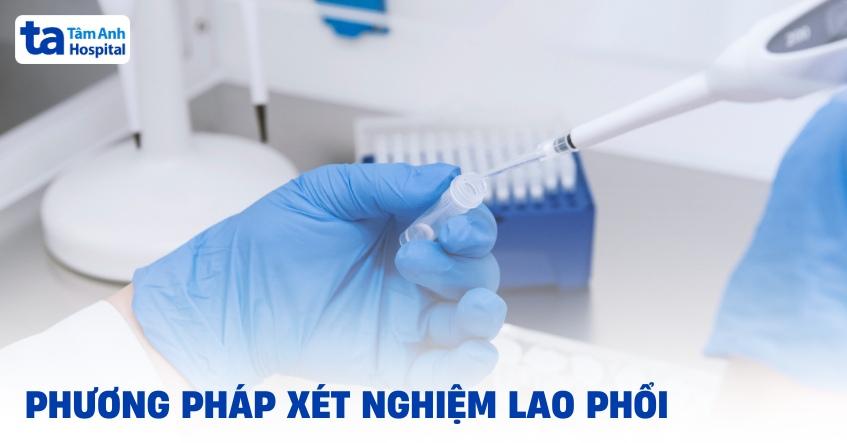 Xét nghiệm lao phổi là gì