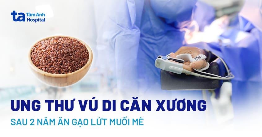 Ung thư vú di căn xương sau 2 năm chỉ ăn gạo lứt muối mè