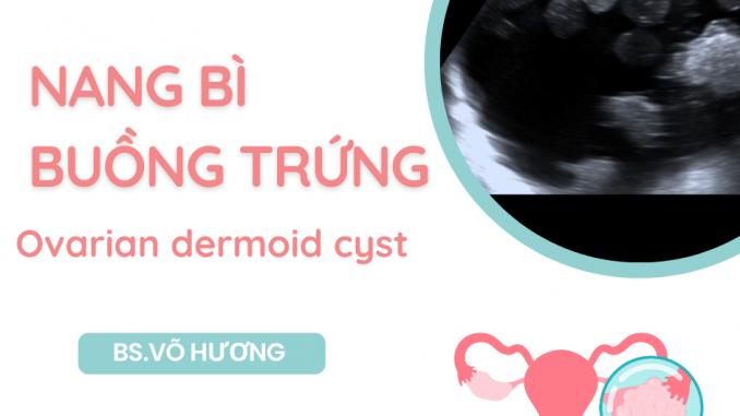 Nang bì buồng trứng (Ovarian dermoid cyst)
