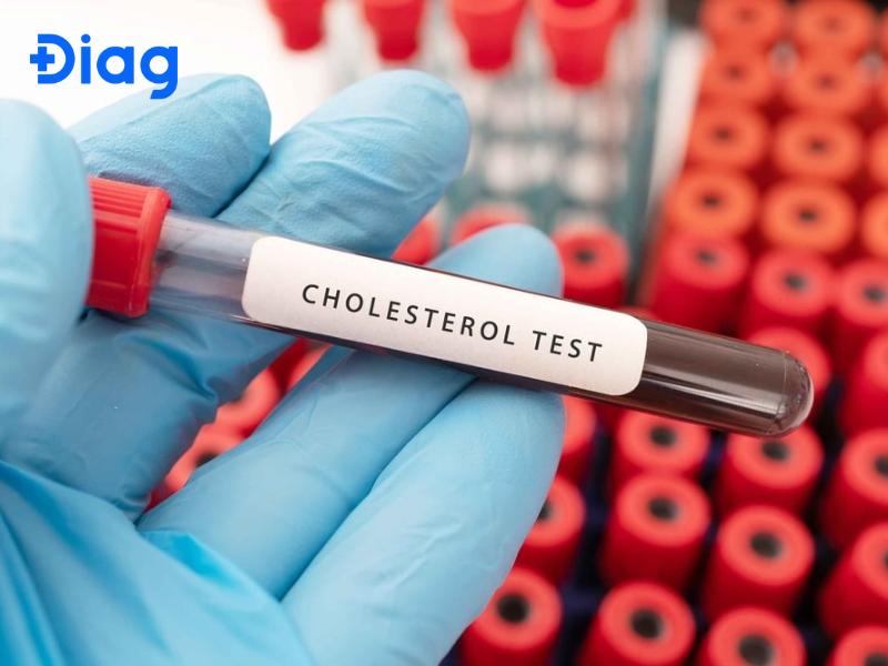 Cách đọc chỉ số hỗ trợ phát hiện gan nhiễm mỡ trong xét nghiệm máu