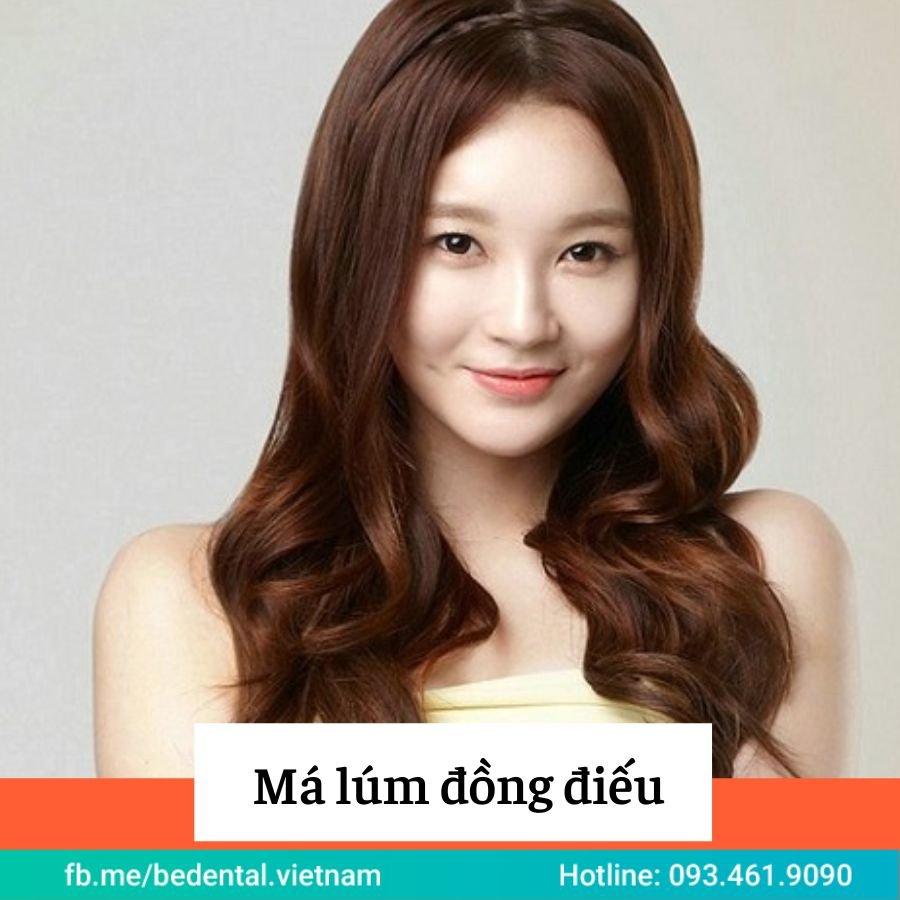 Má lúm đồng điếu, Tướng số của người có má lúm đồng điếu