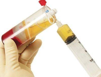 Sự khác nhau giữa huyết thanh và huyết tương