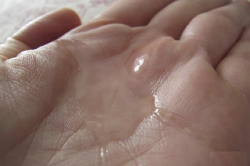 Tư vấn: Tinh dịch trong suốt là sao? Có phải bệnh hay không?