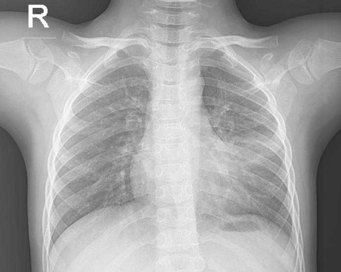 Ưu nhược điểm và ứng dụng tia X trong y học | Khoa học thường thức