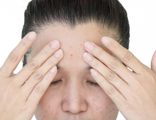 Trán Cao Là Gì? Vận Mệnh Của Người Trán Cao Ra Sao?