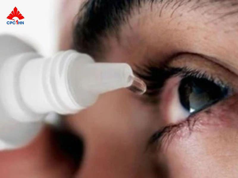 Nhỏ thuốc mắt bị sót có sao không? Cách xử lý