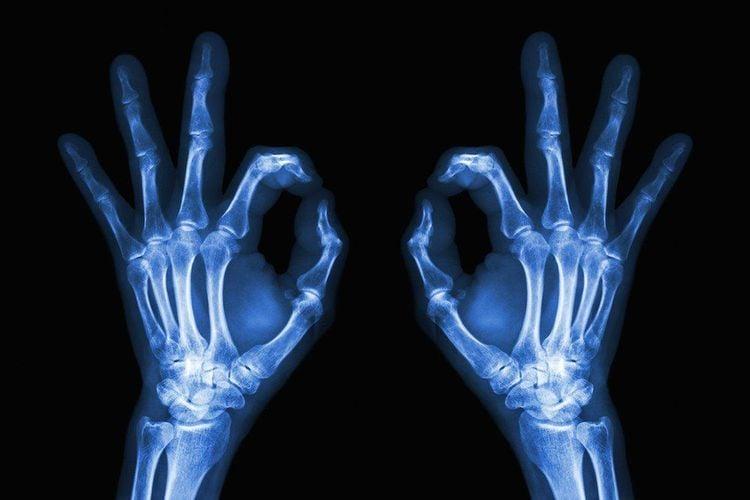 Khả năng xuyên thấu của tia X