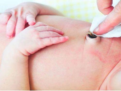 Cắt dây rốn chậm lợi hay hại cho trẻ?