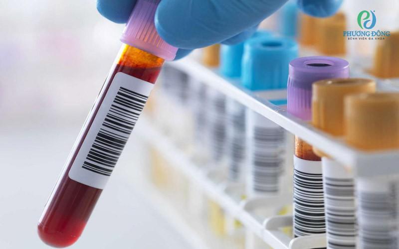 Chỉ số GRAN trong máu là gì? Giải mã vai trò từ A đến Z