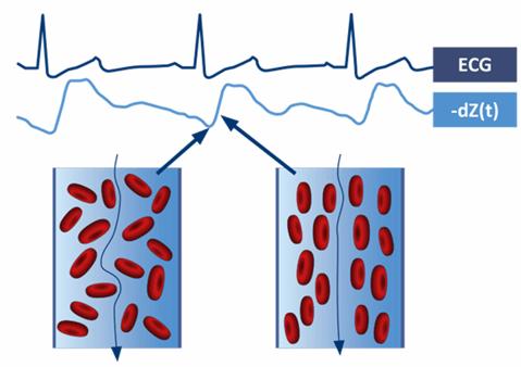 Đặc điểm huyết động học của bệnh nhân tăng huyết áp có tăng chỉ số sức cản mạch hệ thống