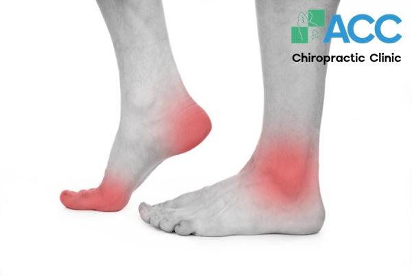 Đau bàn chân: Nguyên nhân, vị trí đau và cách chữa trị hiệu quả